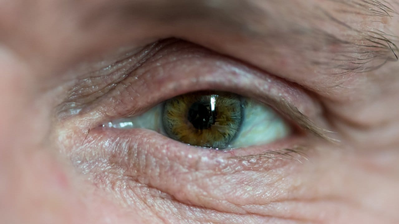 Ein Mann mit einer Augenprothese blickt im Institut für künstliche Augen in die Kamera.