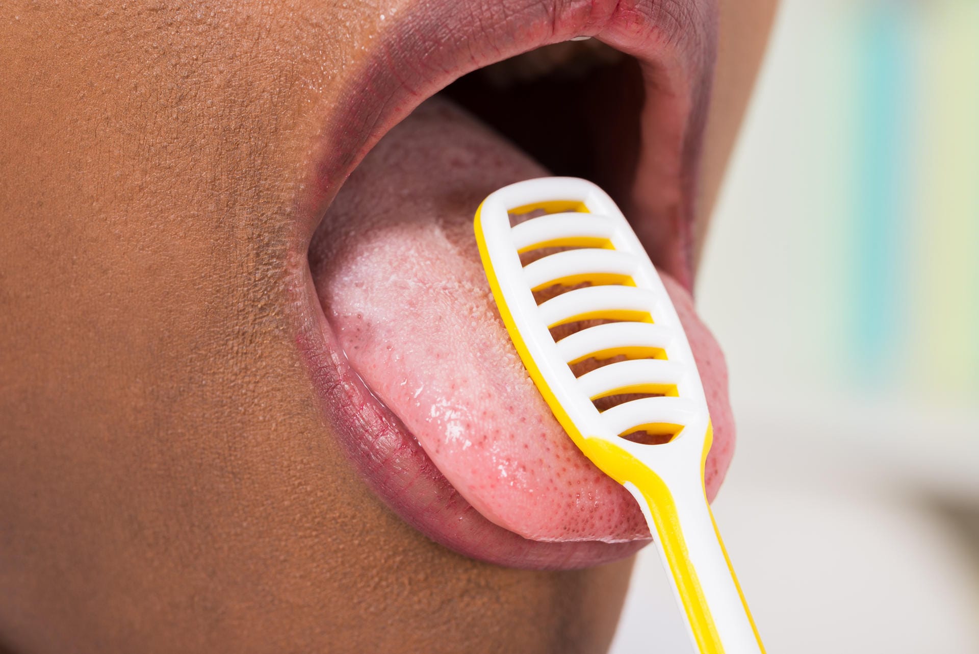 Zunge reinigen: Belag auf der Zunge ist manchmal der Auslöser für Mundgeruch. Ein Zungenschaber kann Abhilfe schaffen.
