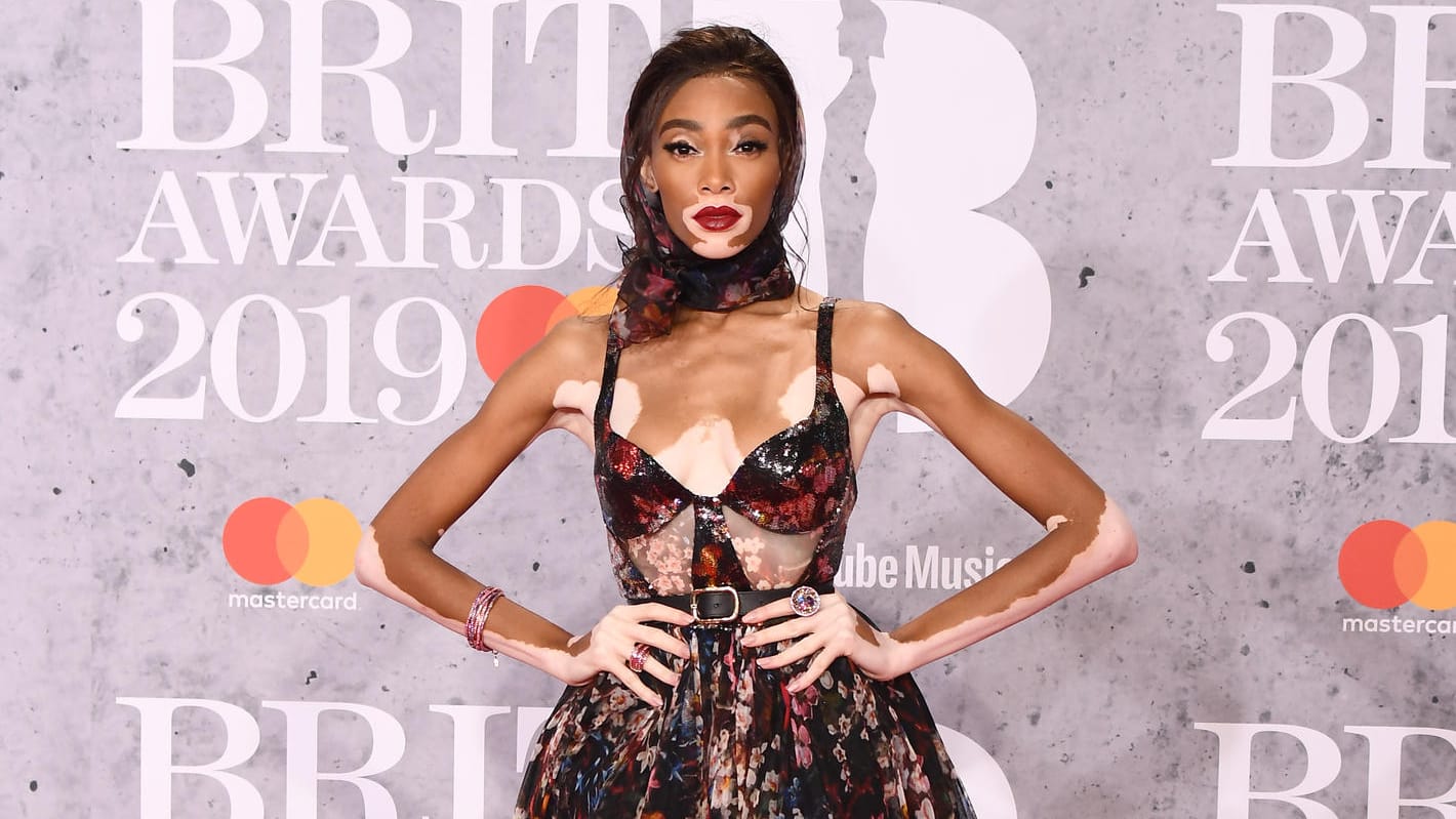 Winnie Harlow