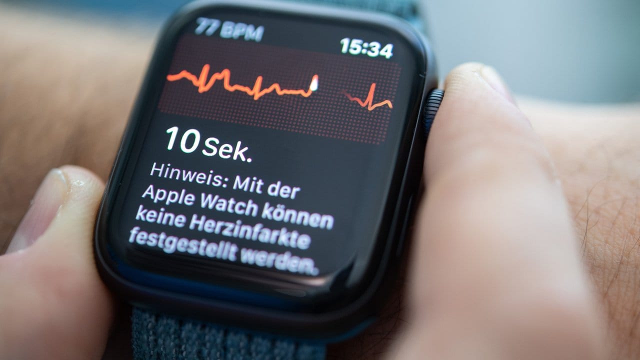 Die Apple Watch kann jetzt auch in Deutschland per EKG die normale Herzfunktion feststellen.