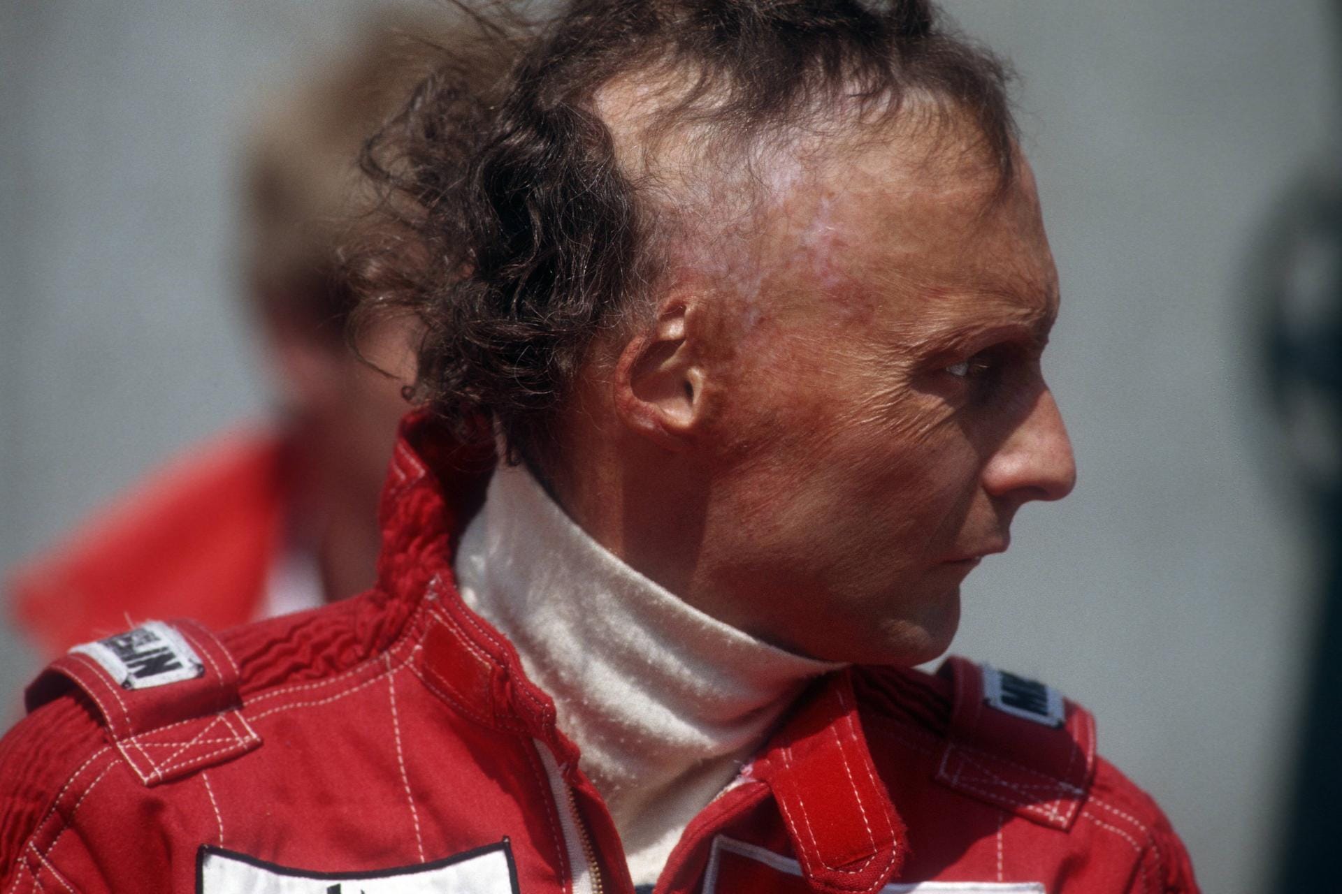 Niki Lauda nach seinem Unfall