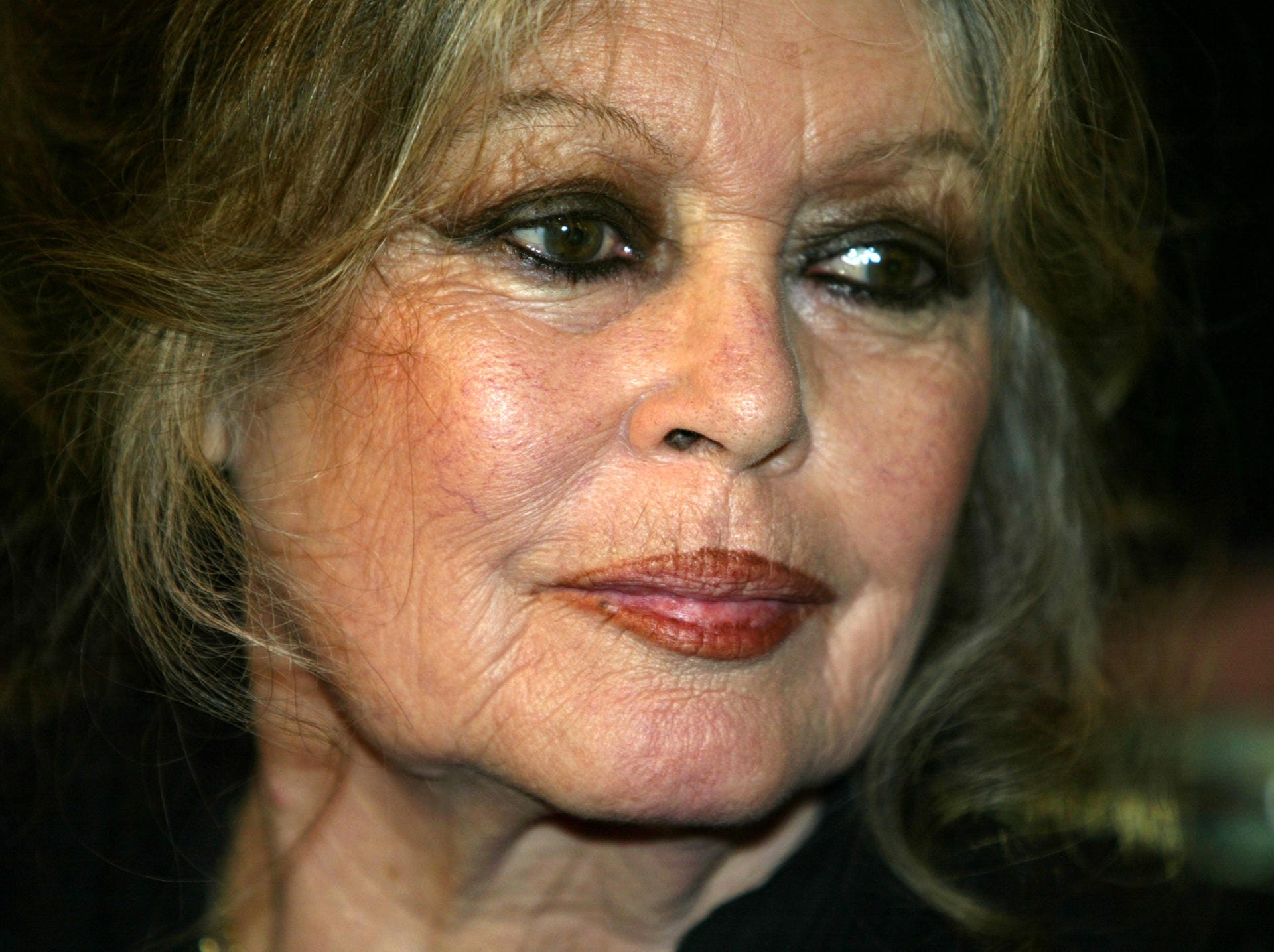 Brigitte Bardot: Die französische Schauspielerin ging in den 1980er-Jahren mit ihrer Brustkrebserkrankung an die Öffentlichkeit.