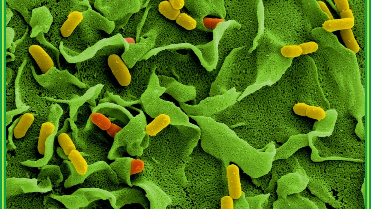 Für gesunde Erwachsene nicht bedrohlich, für Kinder und Menschen mit geschwächtem Immunsystem aber sehr gefährlich: Listerien unter dem Elektronenmikroskop.