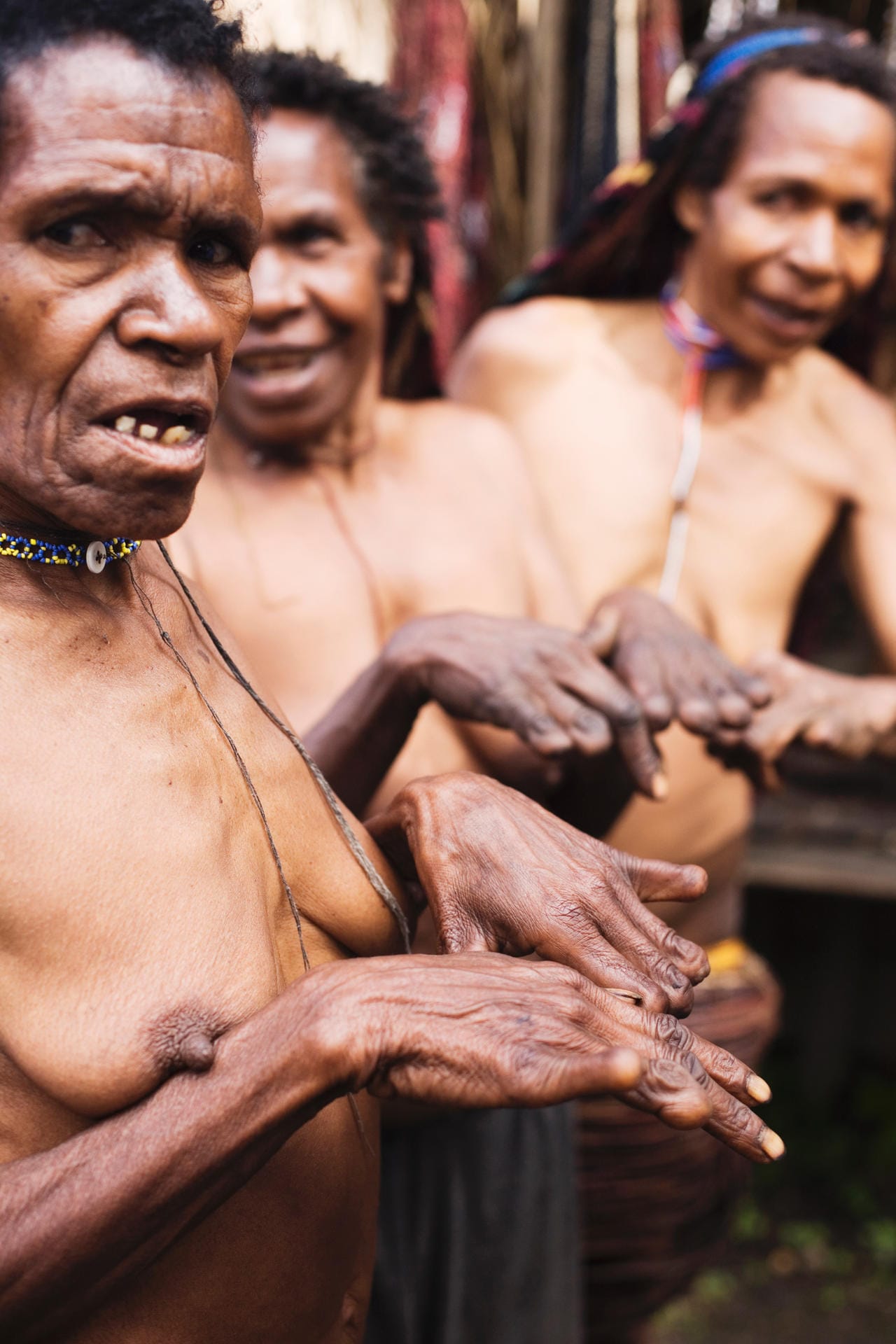 Dani-Stammesmitglieder mit abgetrennten Fingerspitzen