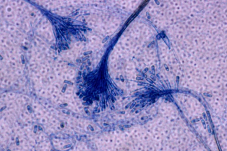 Mikroskopaufnahme Microsporum audouinii: Hautpilz unterm Mikroskop.