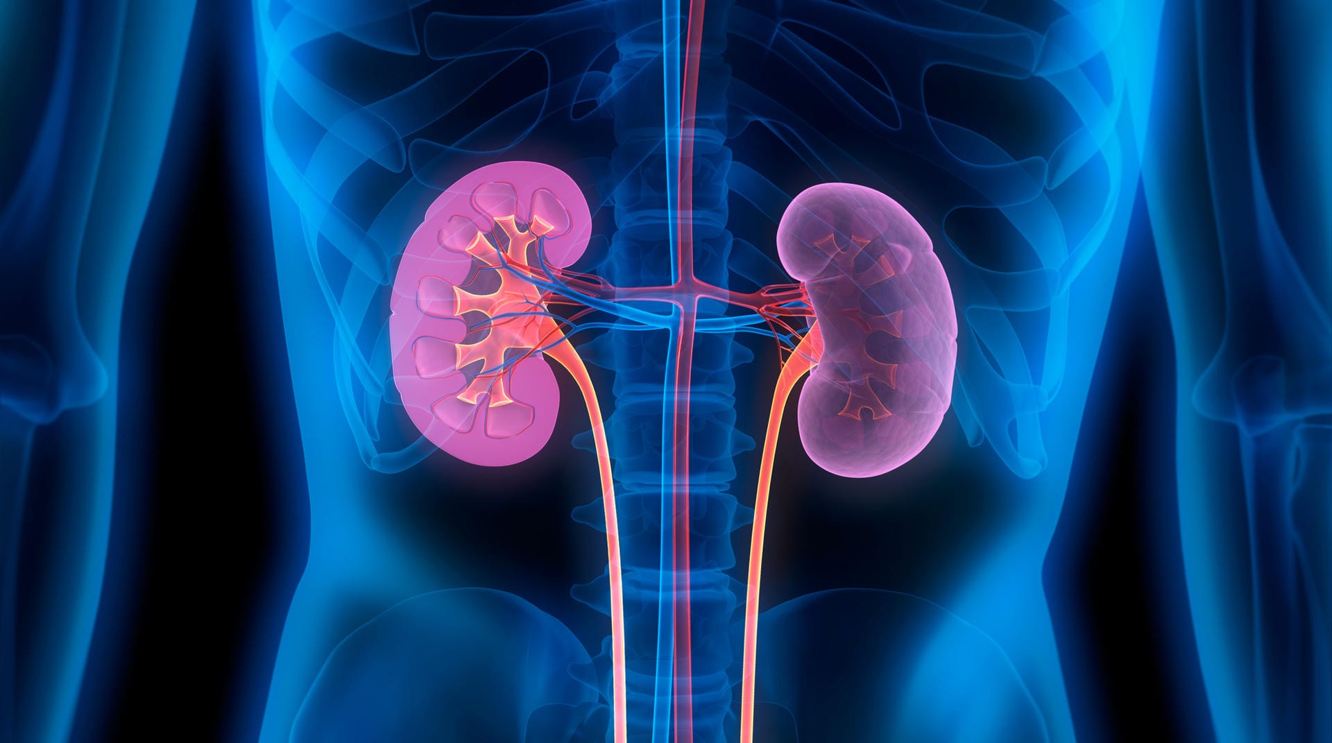 Bei vielen schwer erkrankten Covid-19-Patienten werden auch die Nieren geschädigt. Einer Studie des Universitätsklinikums Hamburg-Eppendorf (UKE) zufolge ist die Niere sogar nach der Lunge das am zweithäufigsten betroffene Organ. Die Ursachen des Befalls werden noch erforscht.