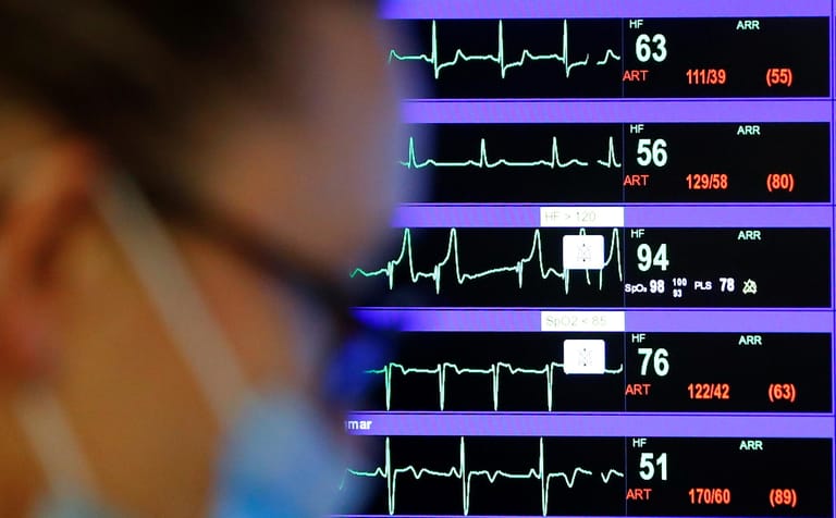 Auf einem Monitor werden die Herztöne aller Intensivpatienten permanent verfolgt.