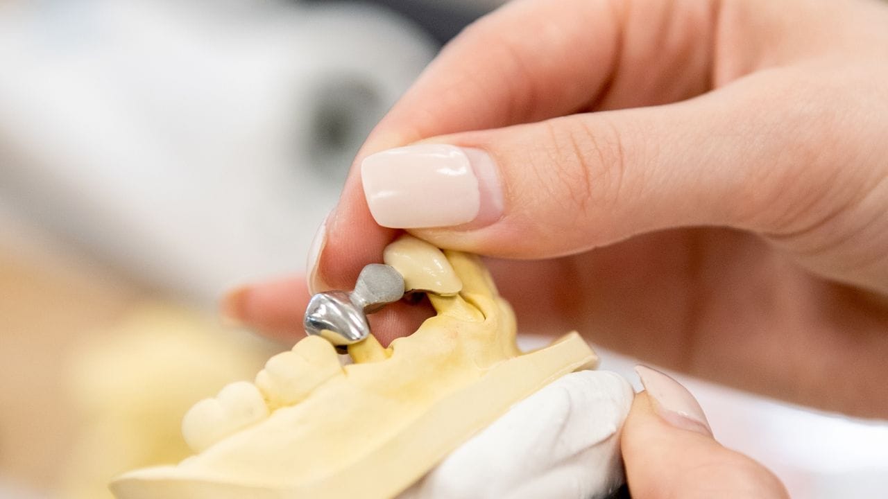 Geht es um den Zahnersatz, müssen Zahntechnikerinnen präzise Arbeit leisten.