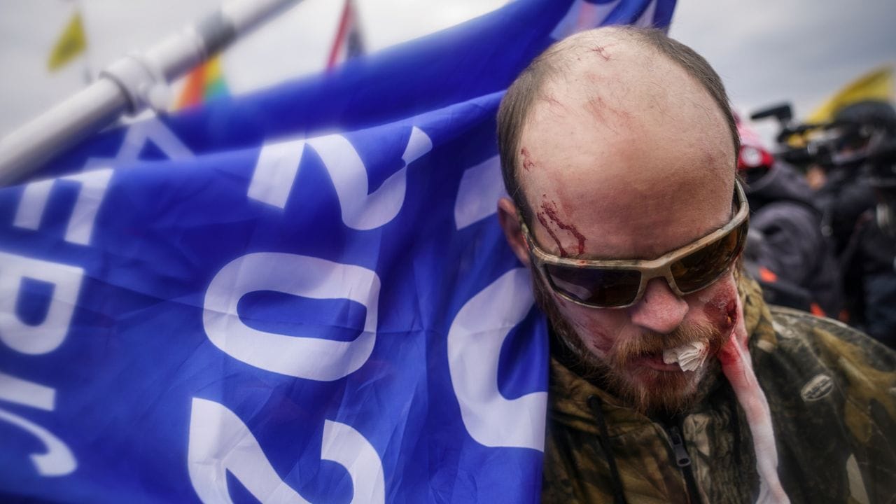Ein verletzter Demonstrant am Rande der Proteste vor dem Kapitol.