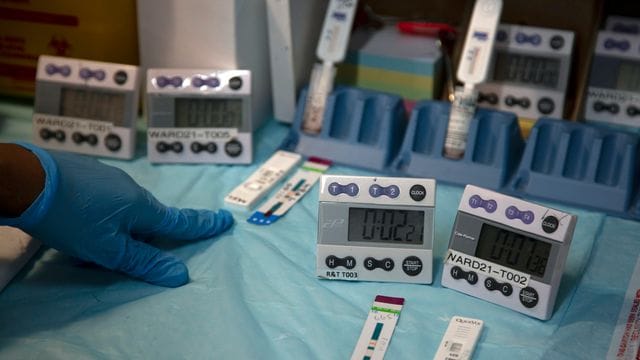 Labortechniker in Südafrika testen eine Blutprobe auf eine HIV-Infektion. Labortechniker in Südafrika testen eine Blutprobe auf eine HIV-Infektion.