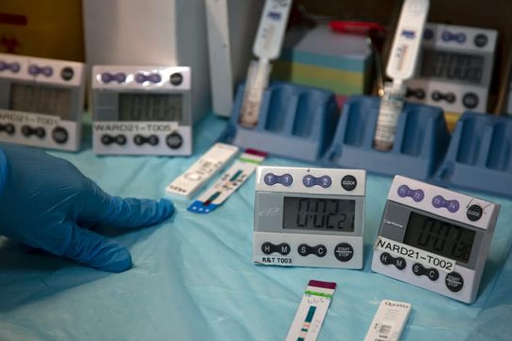 Labortechniker in Südafrika testen eine Blutprobe auf eine HIV-Infektion.