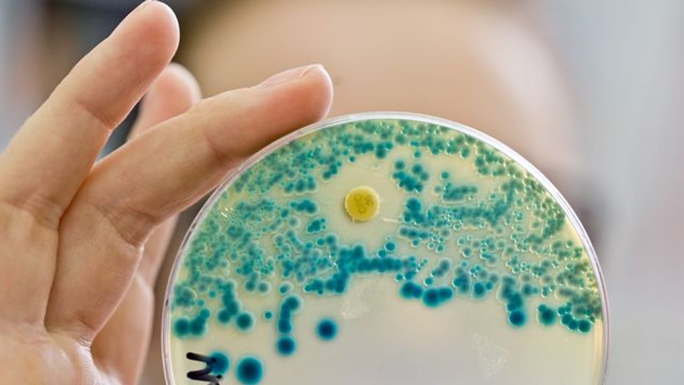 Eine Labormitarbeiterin hält eine Schale zum Nachweis von Antibiotika-resistenten Bakterien in der Hand.