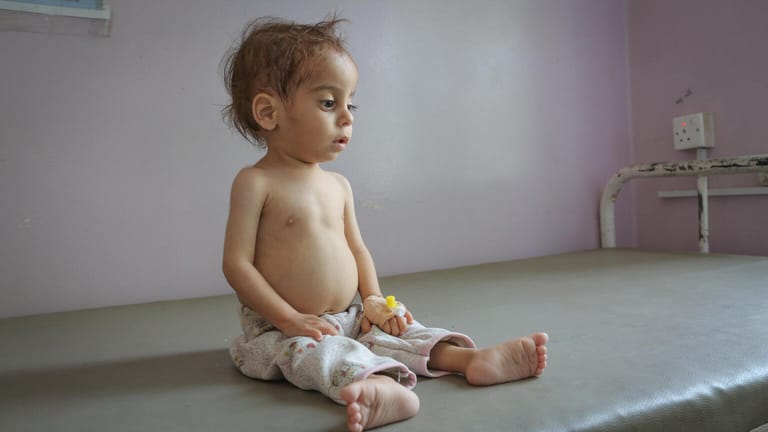 Malik Farid Mohammed, neun Monate alt, in einem Krankenhaus im Jemen. Er ist mangelernährt und bekommt nun Hilfe.