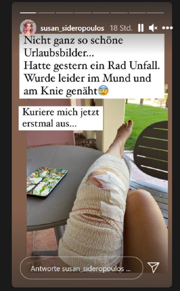 Susan Sideropoulos zeigt in ihrer Story auch ihr bandagiertes Bein.