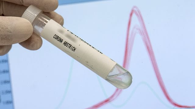 Abstrichröhrchen für Corona-Analyse Abstrichröhrchen für Corona-Analyse