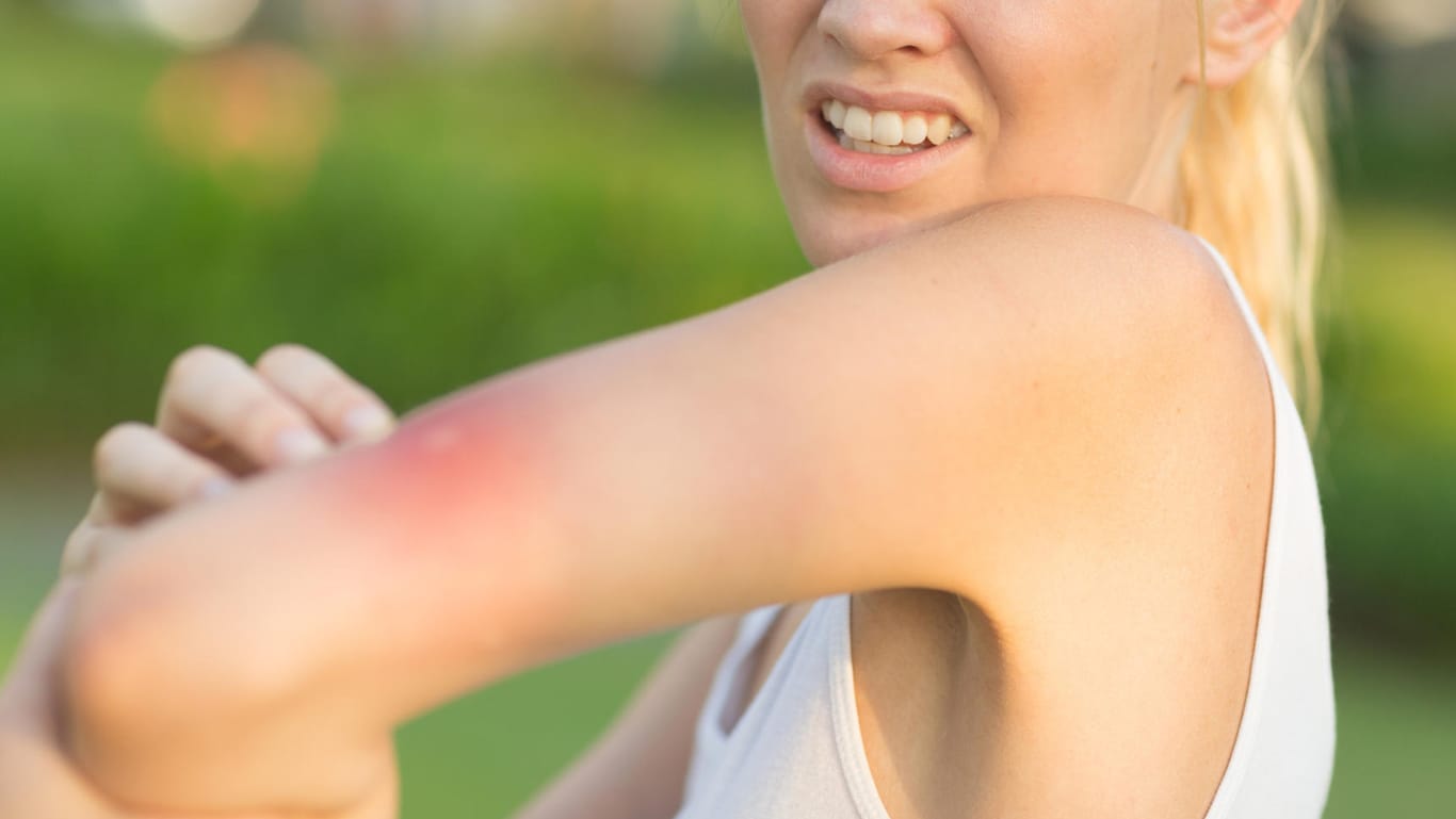 Schmerzen: Einige Insektenstiche oder -bisse spürt man erst lange nachdem das Insekt zugestochen hat.
