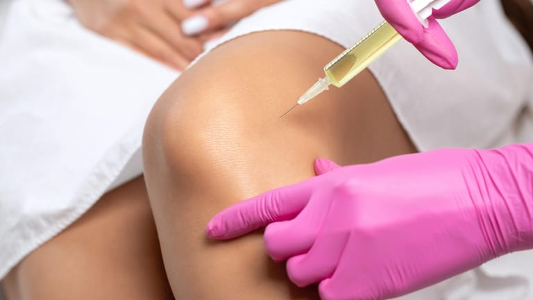 Ein Arzt injiziert einer Patientin eine Spritze ins Knie. Viele Patienten mit Kniearthrose erhoffen sich durch Hyaluron- oder Kortisonspritzen eine Linderung ihrer Beschwerden.