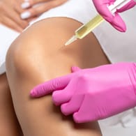 Ein Arzt injiziert einer Patientin eine Spritze ins Knie. Viele Patienten mit Kniearthrose erhoffen sich durch Hyaluron- oder Kortisonspritzen eine Linderung ihrer Beschwerden.