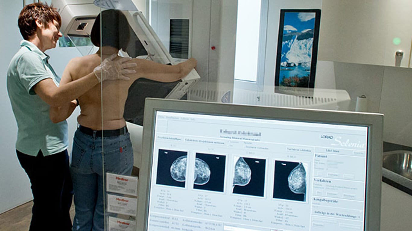 Röntgenaufnahme einer Mammographie