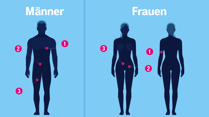 Grafik für die Messpunkte zur Ermittlung des Körperfettanteils bei Frauen und Männern.