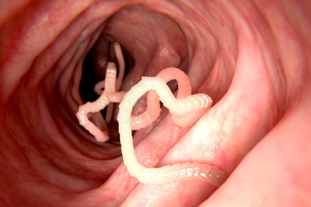 Was man sieht: Ein Bandwurm befällt den Darm. Gegen den Parasiten hilft in der Regel nur eine Wurmkur.