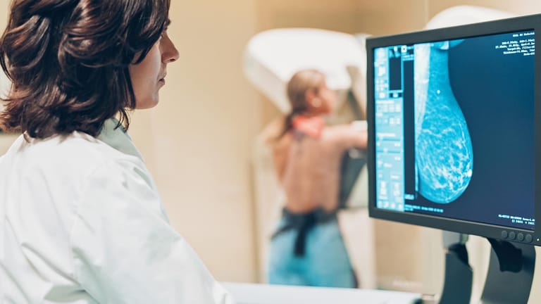Untersuchung: Bei Frauen über 50 sollte regelmäßig eine Mammografie durchgeführt werden.