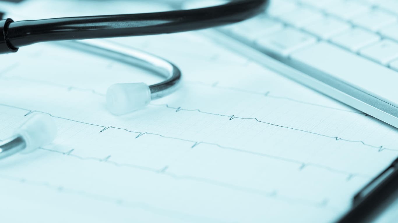 Aufzeichnung des Herzschlags: Auch wenn Herzrasen oft unbedenklich ist, sollten Unregelmäßigkeiten des Herzschlages immer vom Arzt abgeklärt werden.