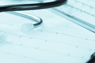 Aufzeichnung des Herzschlags: Auch wenn Herzrasen oft unbedenklich ist, sollten Unregelmäßigkeiten des Herzschlages immer vom Arzt abgeklärt werden.