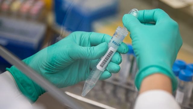 Corona-Proben werden im Labor untersucht.