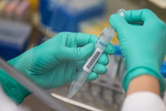 Corona-Proben werden im Labor untersucht.