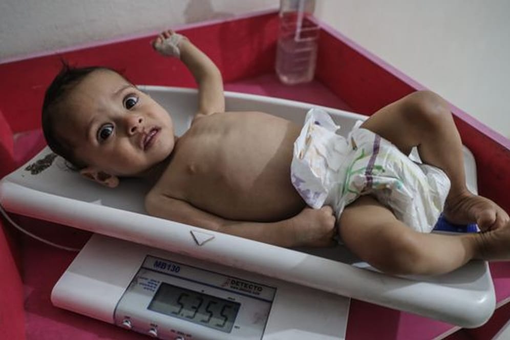 Eine Krankenschwester ermittelt das Gewicht eines unterernährten Kindes im Ibn Sina Krankenhaus in Idlib.