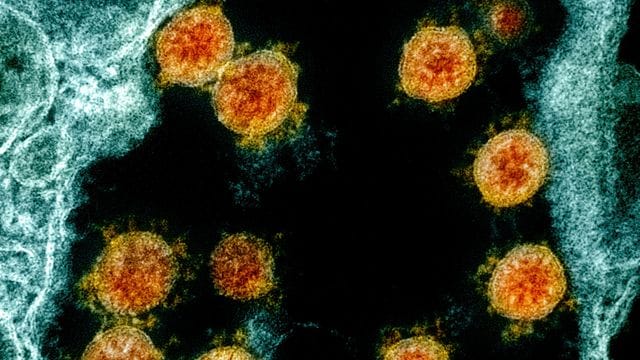 Elektronenmikroskopische Aufnahme von Partikeln des Coronavirus SARS-CoV-2. Elektronenmikroskopische Aufnahme von Partikeln des Coronavirus SARS-CoV-2.
