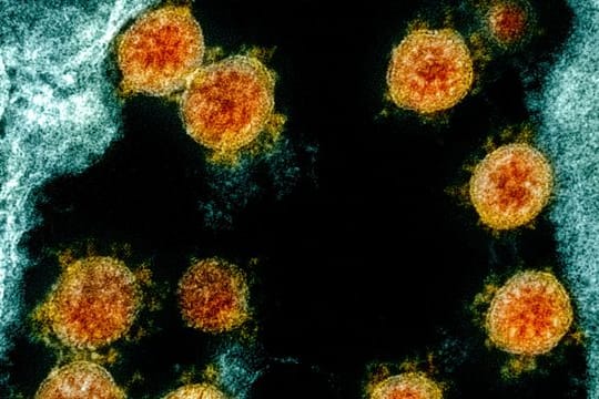 Elektronenmikroskopische Aufnahme von Partikeln des Coronavirus SARS-CoV-2.