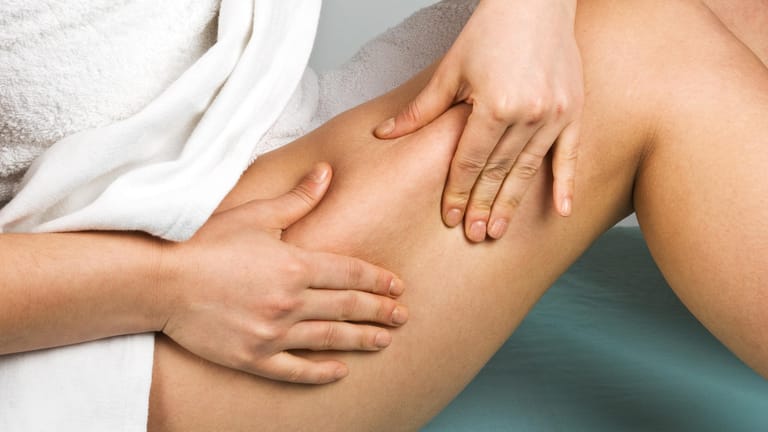 Eine Frau drückt mit den Händen die Haut ihres Oberschenkels. Beim sogenannten "Kneiftest" lässt sich Cellulite im Frühstadium erkennen.