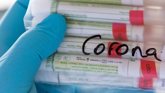 Corona-Tests Corona-Tests