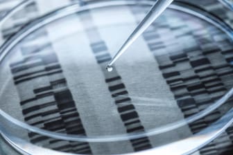DNA-Probe in einer Petrischale: Mittels eines Tests konnte in Großbritannien eine Vergewaltigung nach 40 Jahren aufgeklärt werden. (Symbolfoto)