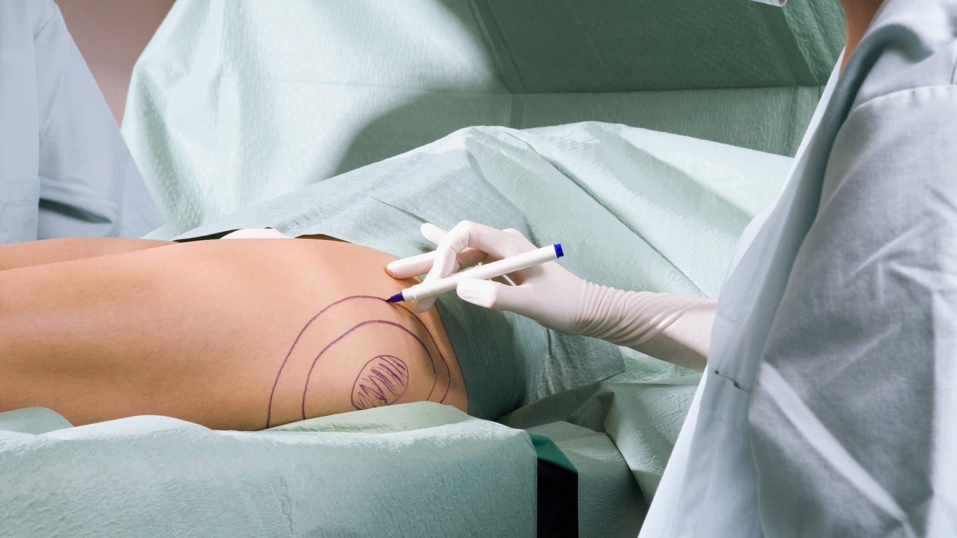 Ein Arzt führt eine Operation durch (Symbolbild): Bisher hat sich der Angeklagte nicht zu den Todesfällen geäußert. Ein Arzt führt eine Operation durch (Symbolbild): Bisher hat sich der Angeklagte nicht zu den Todesfällen geäußert.