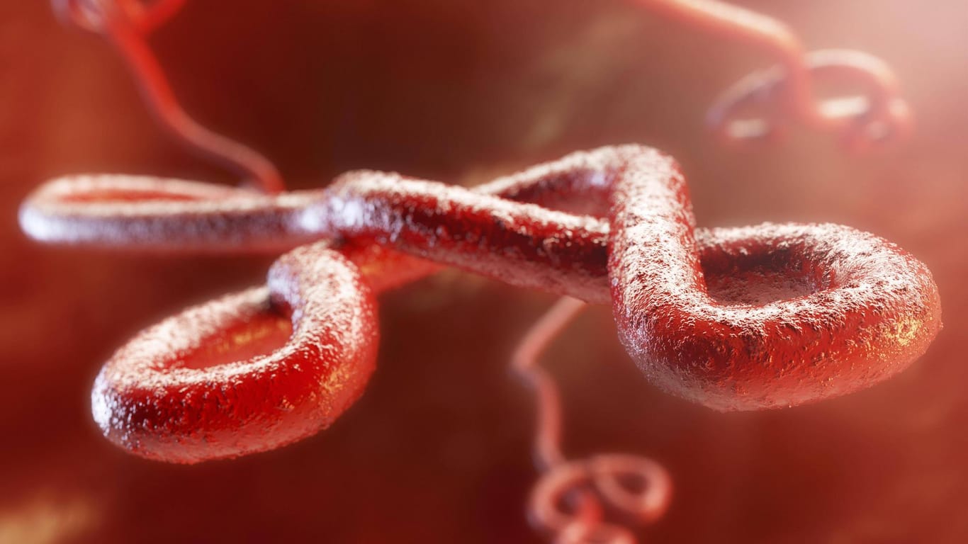 Ein Ebola-Virus unter dem Mikroskop (Archivbild). Jetzt ist ein neuer Fall aufgetaucht.