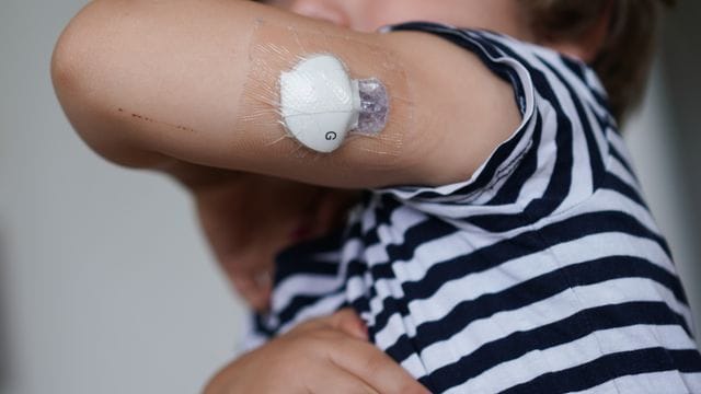 Auch wenn sie über eine Pumpe regelmäßig mit Insulin versorgt werden, haben Kinder mit Diabetes einen erschwerten Alltag.