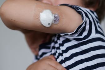 Auch wenn sie über eine Pumpe regelmäßig mit Insulin versorgt werden, haben Kinder mit Diabetes einen erschwerten Alltag.