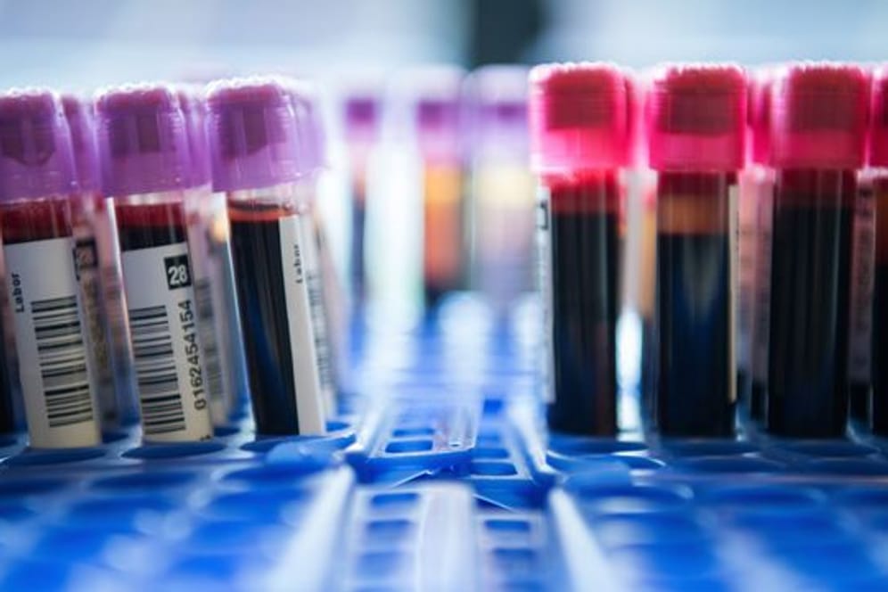 Spezielle Tests: Sie können Erbgut von Krebszellen im Blut nachweisen.