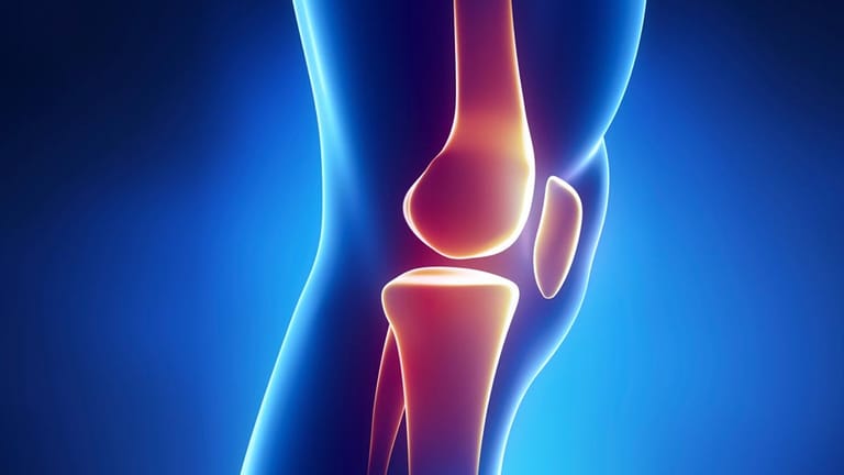Arthrose: Unser Knie ist extrem anfällig für Verletzungen.