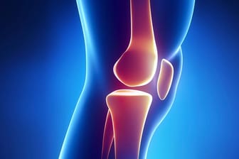 Arthrose: Unser Knie ist extrem anfällig für Verletzungen.