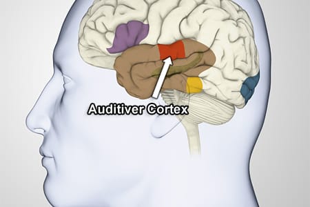 Bisher wurde das Sprachzentrum hinter dem auditiven Cortex vermutet. Nun gehen US-Forscher davon aus, dass es sich drei Zentimeter weiter vorne befindet