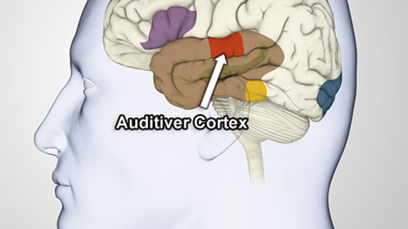 Bisher wurde das Sprachzentrum hinter dem auditiven Cortex vermutet. Nun gehen US-Forscher davon aus, dass es sich drei Zentimeter weiter vorne befindet