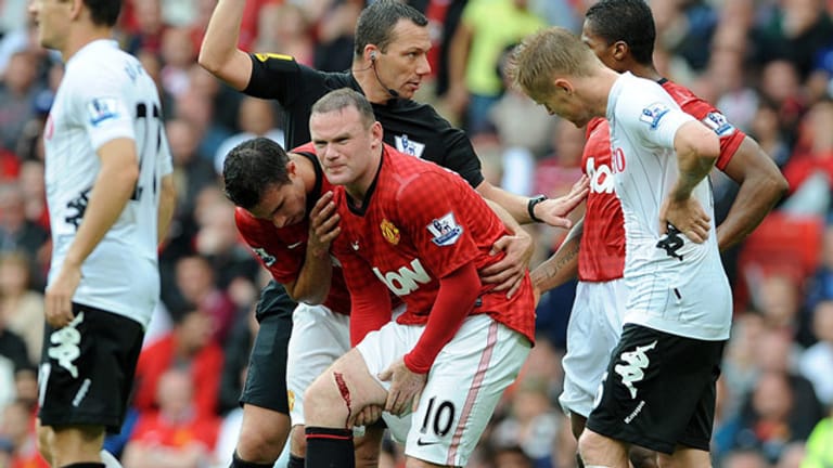 Wayne Rooney am zweiten Premier-League-Spieltag mit einer schwere Schnittwunde.