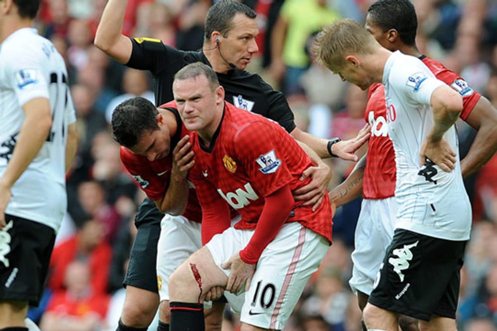 Wayne Rooney am zweiten Premier-League-Spieltag mit einer schwere Schnittwunde.