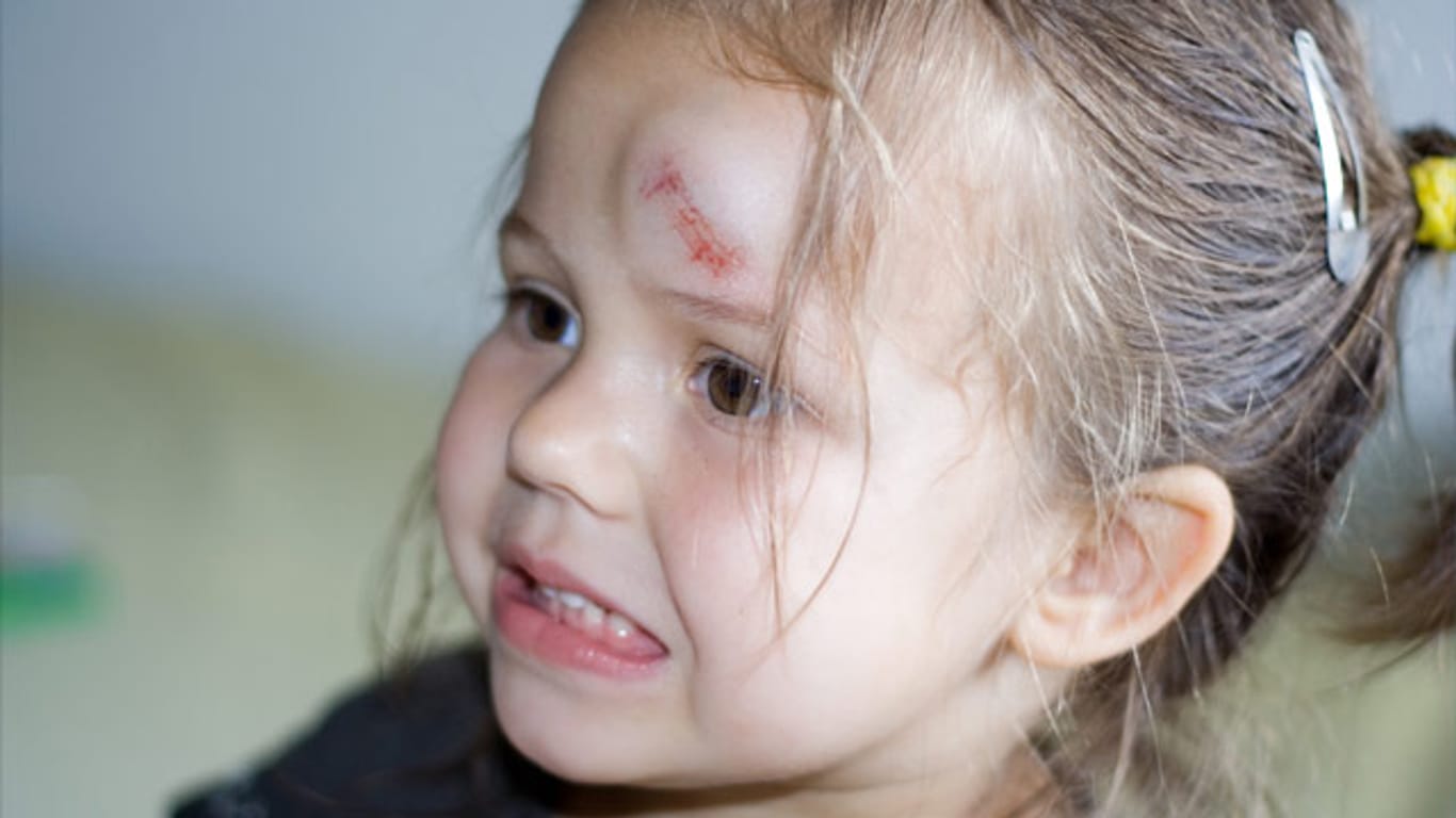 Am häufigsten trifft es bei Unfällen mit Kindern den Kopf.