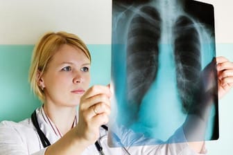 Eine Wasseransammlung in der Lunge wird als Lungenödem bezeichnet.