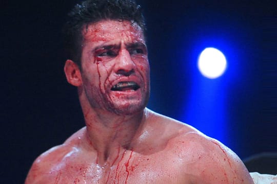 Manuell Charr gezeichnet vom Fight gegen Vitali Klitschko.